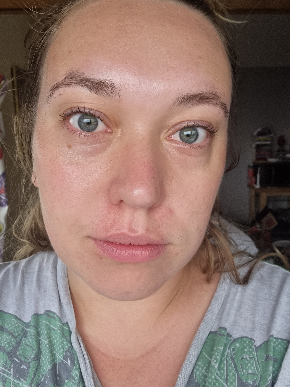 Proven Review - How My Skin Looks