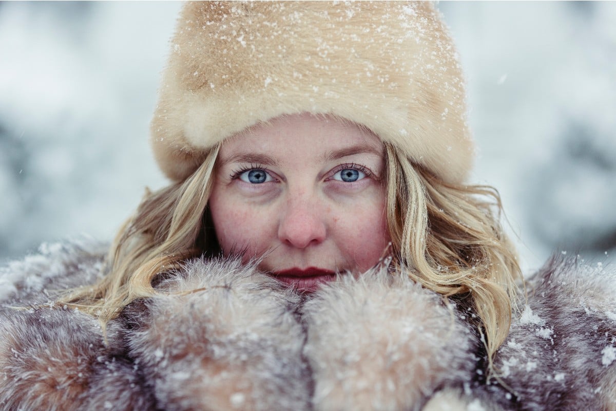 Why You Want Diet C in Your Wintry weather Skin care Regimen