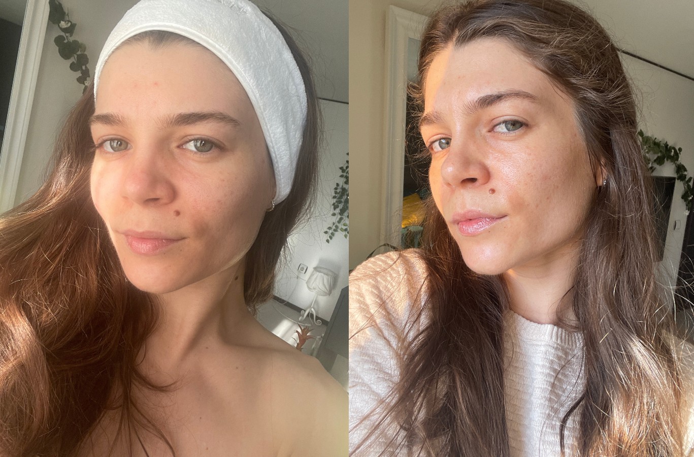 Before And After Clinical Skin Vitamin C Pro-Collagen Serum