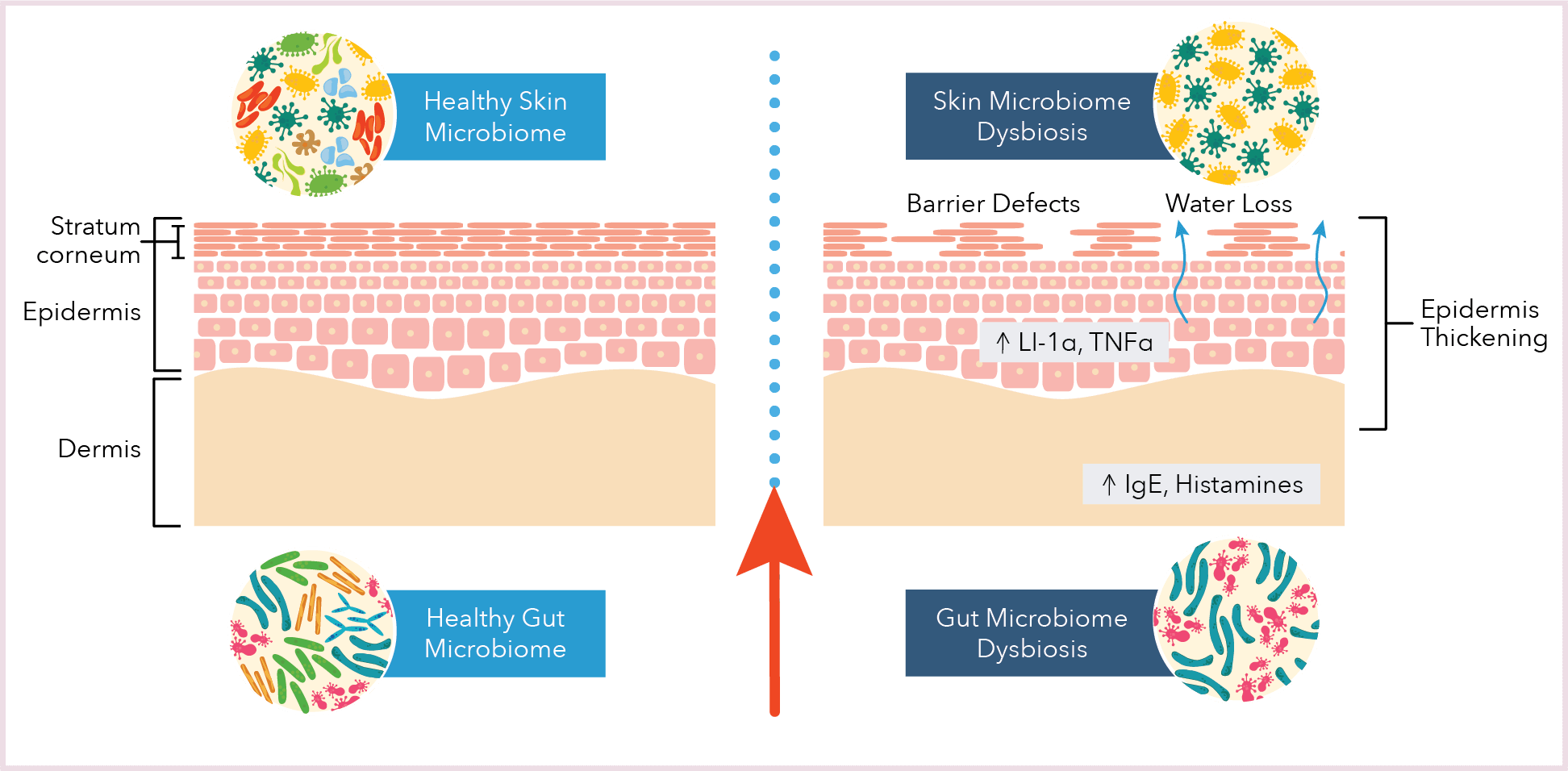 How gut health affect the skin