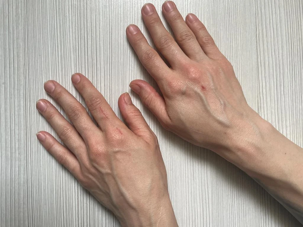 Before Barrier Remedy Hand Cream