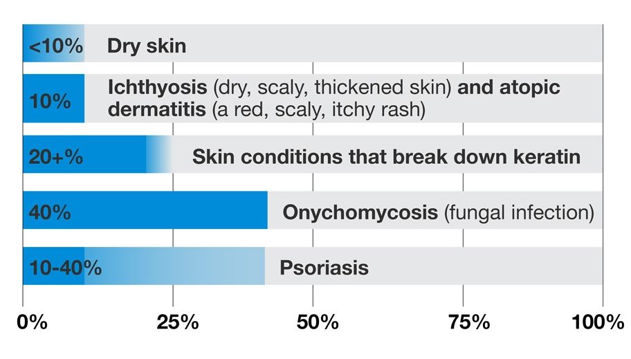 recommended concentration of urea in skincare products