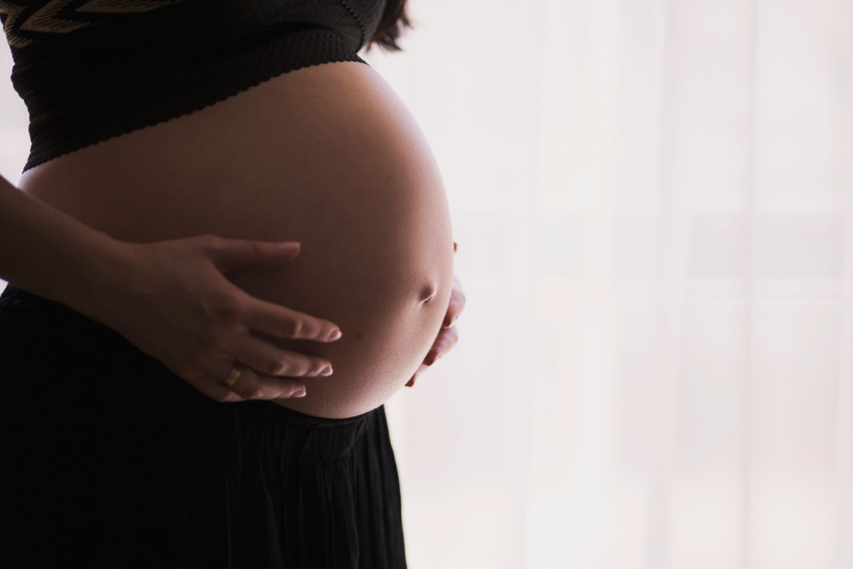 Treatments for Pregnancy Varicose Veins